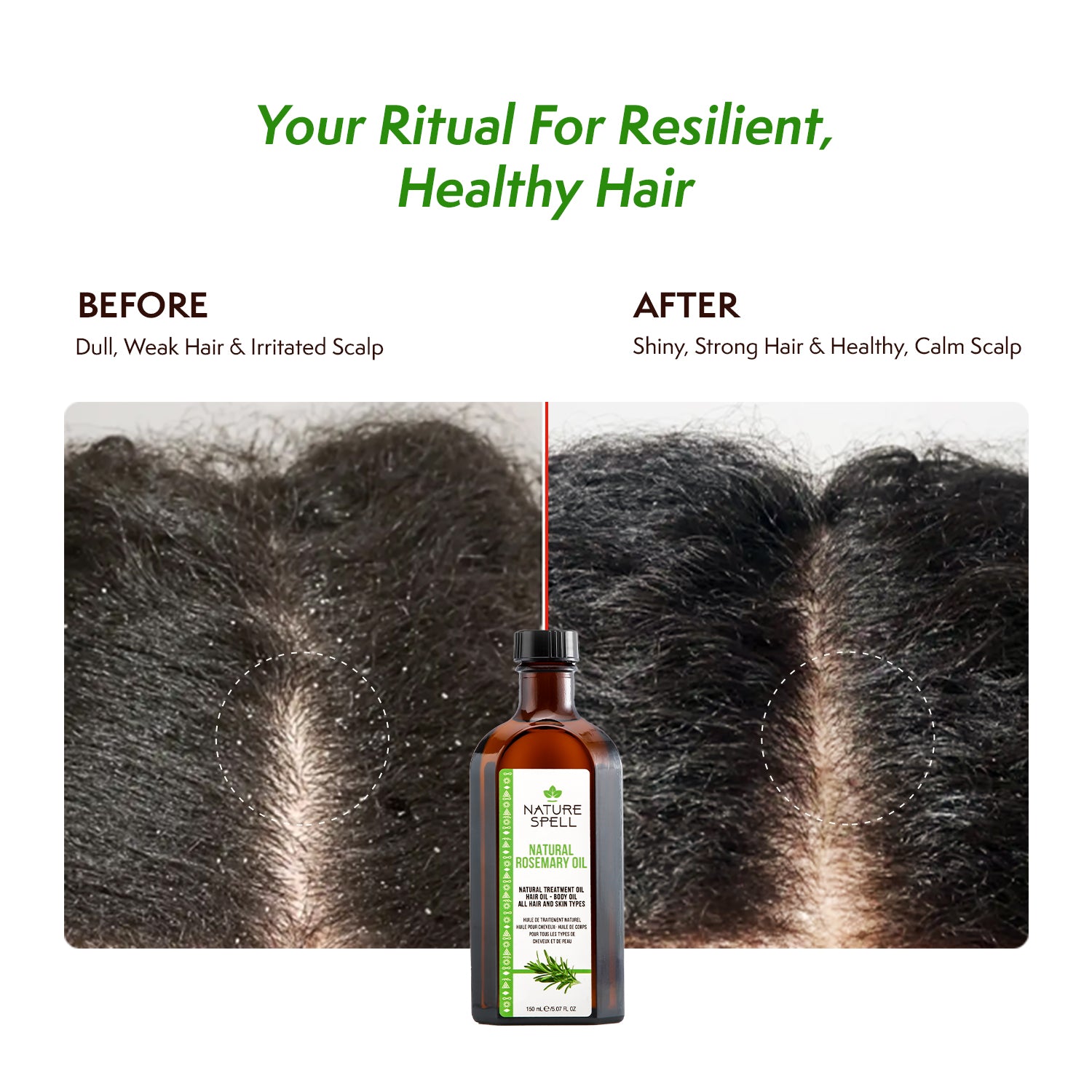 Rosemary Oil For Hair & Scalp